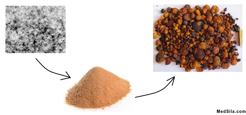 Хлопья, песок, камни желчного пузыря.